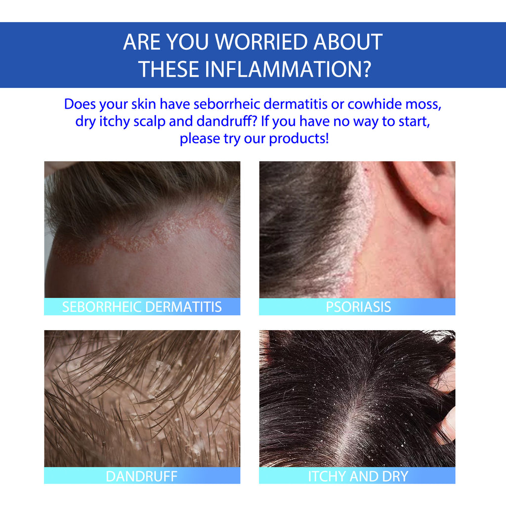 South Moon Seborrheic Dermatitis Skin Repair Cream